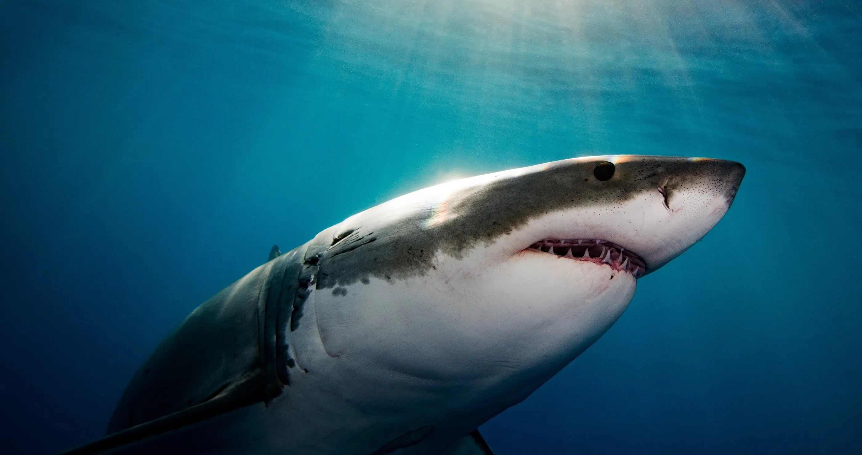 Texas Boy Survives Shark Attack During Bahamas Family Trip